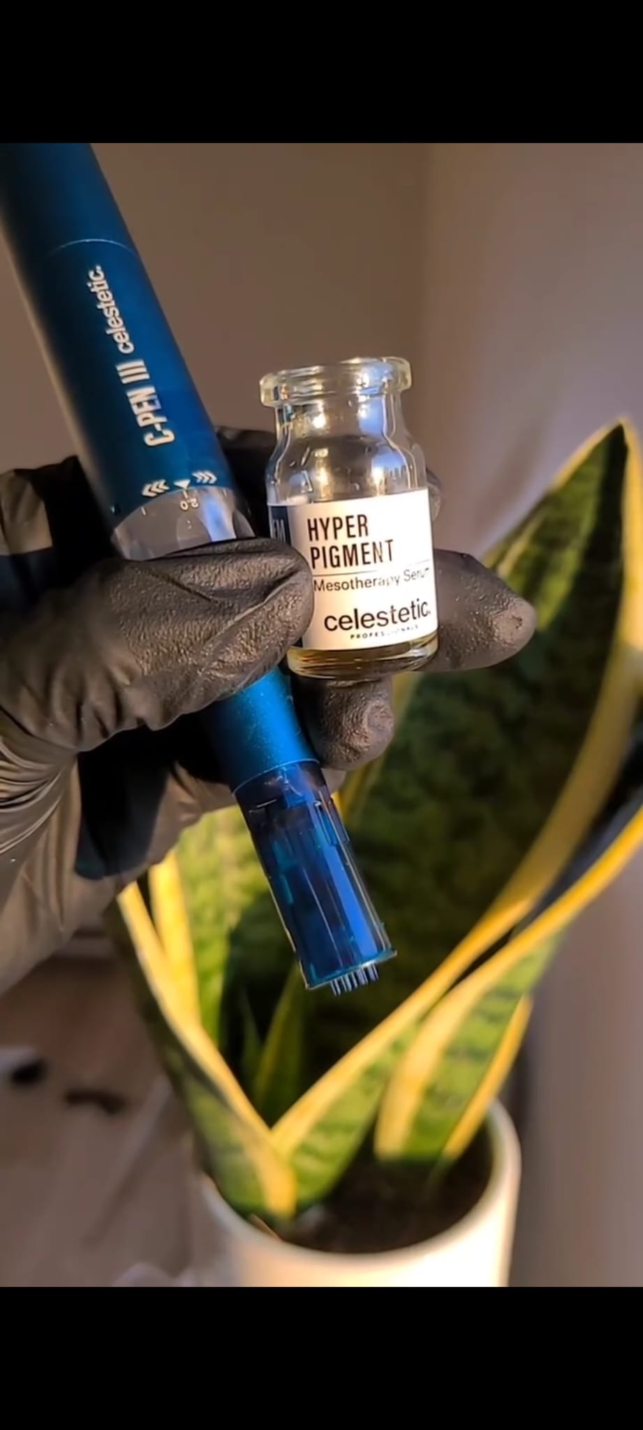 Microneedling huidverbetering bij Studio 13
